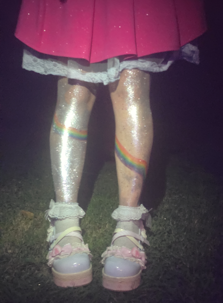 glitterbruises
